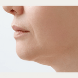 Orgahue RG Cell Ampoule (4ml × 5ea) | CYTOEXOSOME™ Anti-Aging